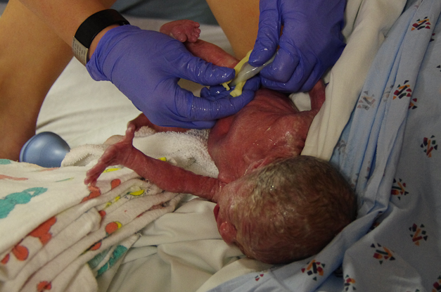Caris was crying and moving immediatly after birth! 