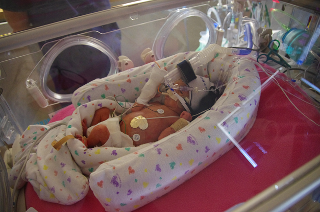 Finally her eyes are open!